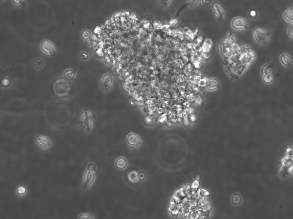 B-LCL-HROC130 cell
