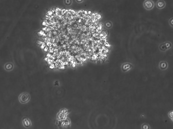 B-LCL-HROC195 cell