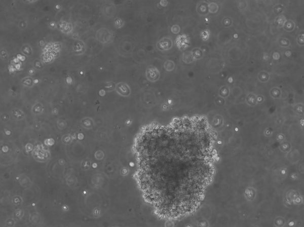 B-LCL-HROC32 (Bc HROC32) cell