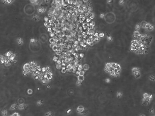 B-LCL-HROC43 cell