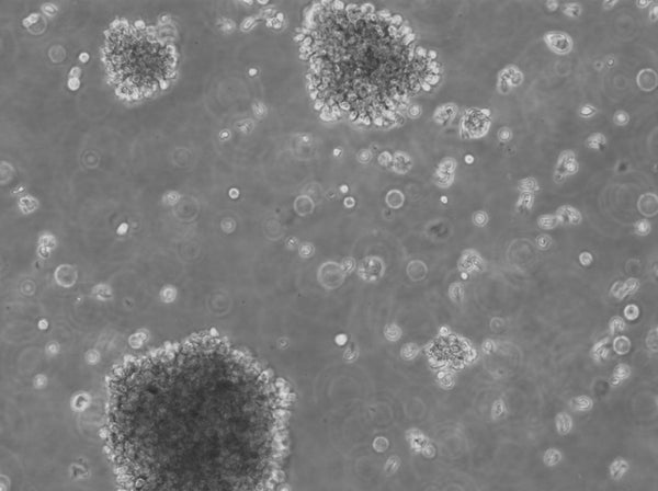 B-LCL-HROC60 cell