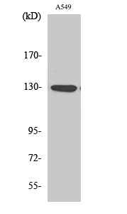 Phospho-JAK1 (Tyr1022) Polyclonal Antibody – Figure 1 of 4