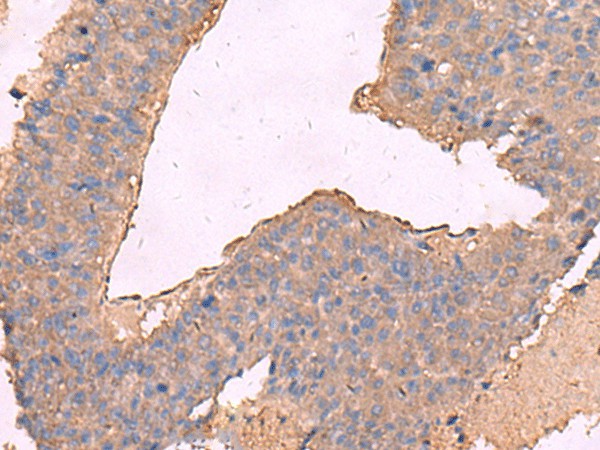 KCNN2 Polyclonal Antibody – Figure 1 of 3