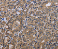 GADD45B Polyclonal Antibody – Figure 1 of 3