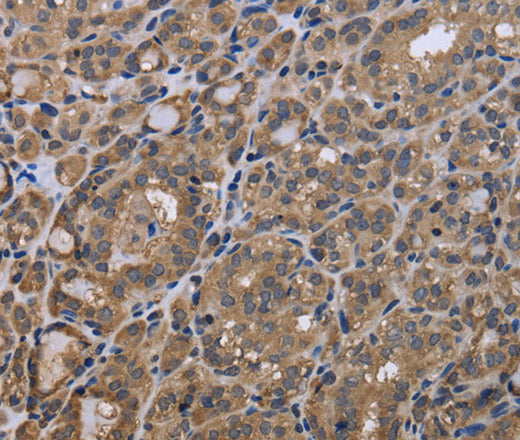 GADD45B Polyclonal Antibody – Figure 1 of 3