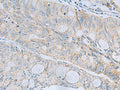 MSI2 Polyclonal Antibody – Figure 1 of 3