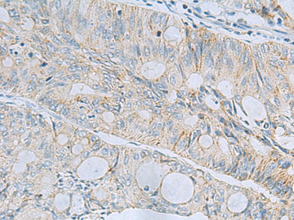 MSI2 Polyclonal Antibody – Figure 1 of 3