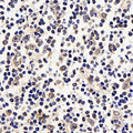 p21 Polyclonal Antibody – Figure 1 of 3