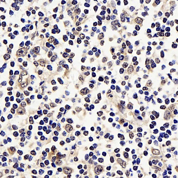 p21 Polyclonal Antibody – Figure 1 of 3