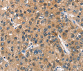 ASB2 Polyclonal Antibody – Figure 1 of 3