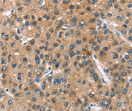 ASB2 Polyclonal Antibody – Figure 1 of 3