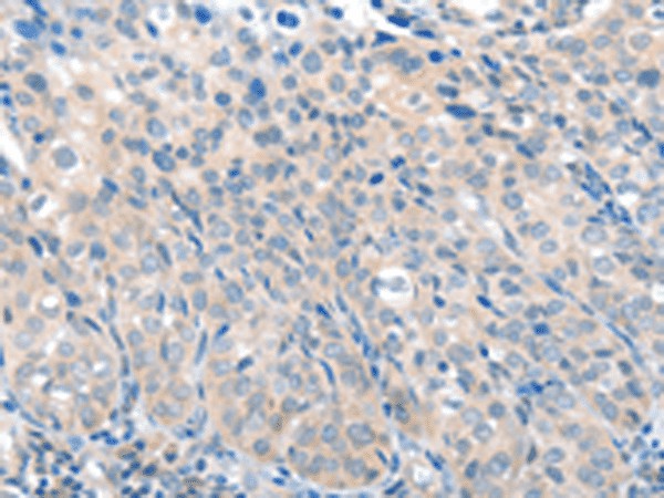 SLC17A6 Polyclonal Antibody – Figure 1 of 3