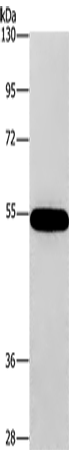 CNDP1 Polyclonal Antibody – Figure 1 of 4