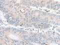 PDE6D Polyclonal Antibody – Figure 1 of 3