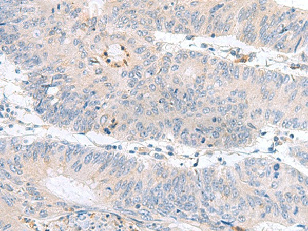 PDE6D Polyclonal Antibody – Figure 1 of 3