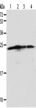 BAK1 Polyclonal Antibody – Figure 1 of 4