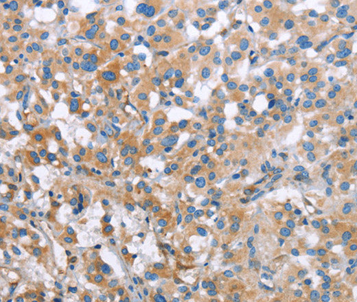 MCL1 Polyclonal Antibody – Figure 1 of 2