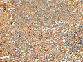 ASMTL Polyclonal Antibody – Figure 1 of 3