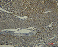 Transferrin Monoclonal Antibody – Figure 1 of 2