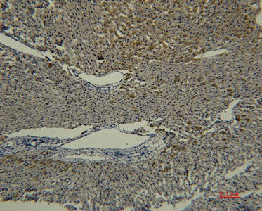 Transferrin Monoclonal Antibody – Figure 1 of 2