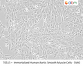 Immortalized Human Aortic Smooth Muscle Cells - SV40 | Applied Biological Materials (abm)