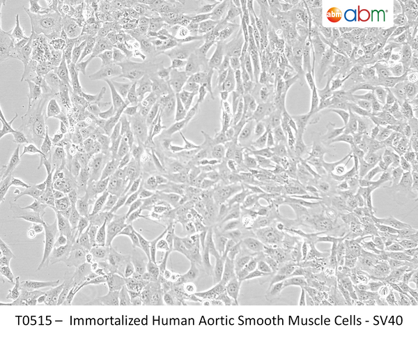 Immortalized Human Aortic Smooth Muscle Cells - SV40 | Applied Biological Materials (abm)