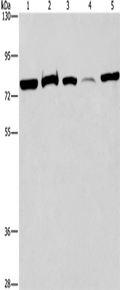 ACVR2A Polyclonal Antibody – Figure 1 of 2