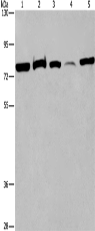 ACVR2A Polyclonal Antibody – Figure 1 of 2
