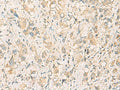 F11R Polyclonal Antibody – Figure 1 of 2