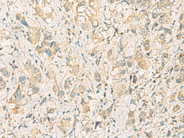 F11R Polyclonal Antibody – Figure 1 of 2