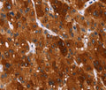 HSPB6 Polyclonal Antibody – Figure 1 of 3