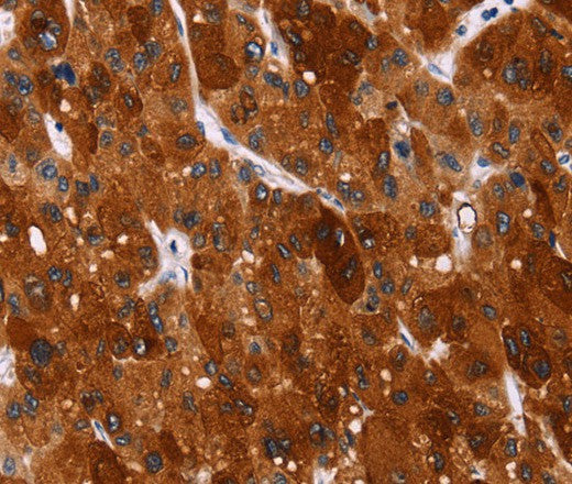 HSPB6 Polyclonal Antibody – Figure 1 of 3