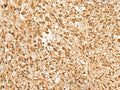 JPT2 Polyclonal Antibody – Figure 1 of 3
