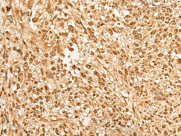 JPT2 Polyclonal Antibody – Figure 1 of 3