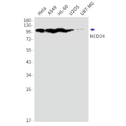 Recombinant NEDD4 Monoclonal Antibody – Figure 1 of 2