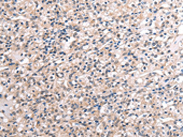 RNF115 Polyclonal Antibody – Figure 1 of 3