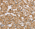 DIO1 Polyclonal Antibody – Figure 1 of 3