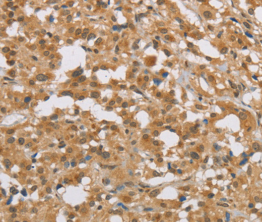 DIO1 Polyclonal Antibody – Figure 1 of 3