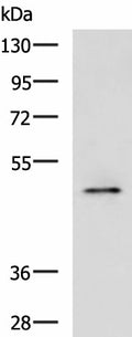 PDK4 Polyclonal Antibody – Figure 1 of 2