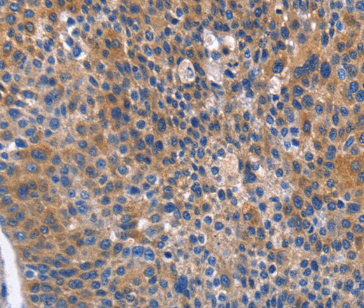 ARRB1 Polyclonal Antibody – Figure 1 of 3