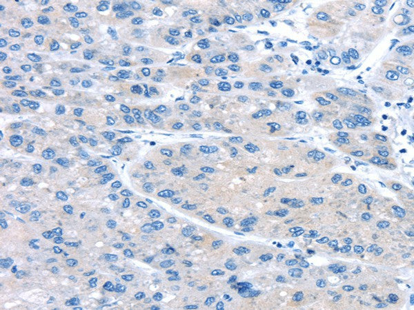 UCP2 Polyclonal Antibody – Figure 1 of 3