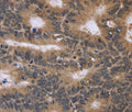 FGFR1OP2 Polyclonal Antibody – Figure 1 of 2