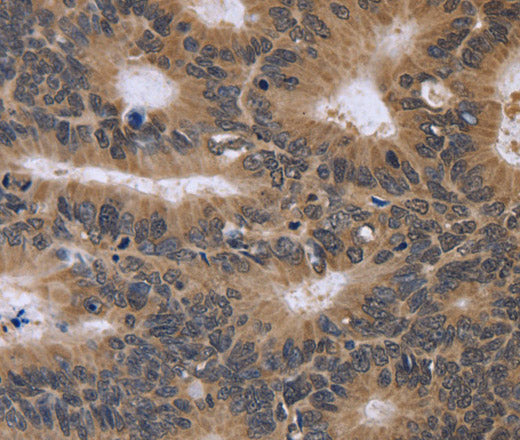 FGFR1OP2 Polyclonal Antibody – Figure 1 of 2