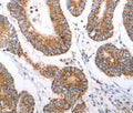 HCRTR1 Polyclonal Antibody – Figure 1 of 3