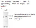 Anti-BAL Antibody – Figure 1 of 1