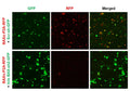h/m BAX shRNA Lentivirus – Figure 1 of 2
