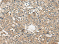 FUT4 Polyclonal Antibody – Figure 1 of 3