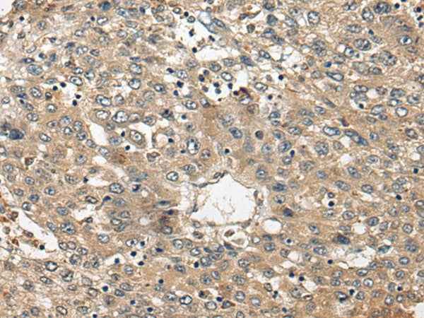 FUT4 Polyclonal Antibody – Figure 1 of 3