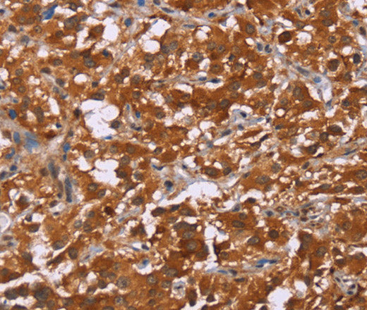 DCBLD2 Polyclonal Antibody – Figure 1 of 4