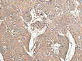 KRT73 Polyclonal Antibody – Figure 1 of 3